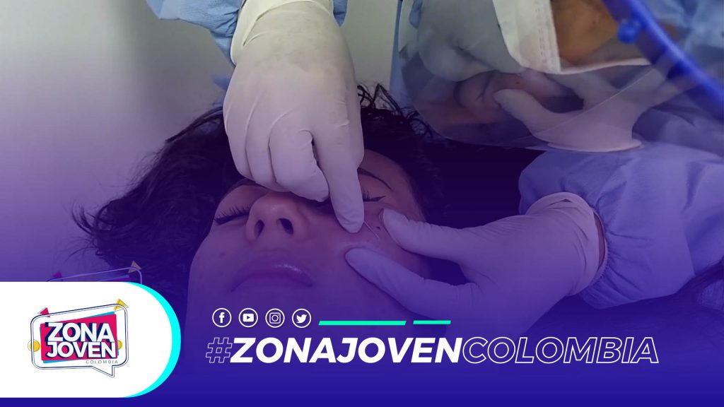 Comedolisis y Peeling Facial, tratamiento para eliminar las lesiones del acné