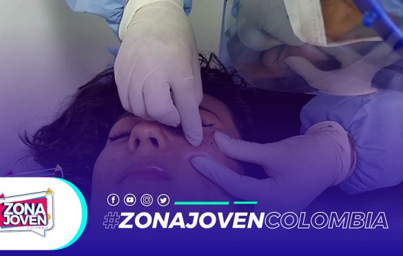  Comedolisis y Peeling Facial, tratamiento para eliminar las lesiones del acné